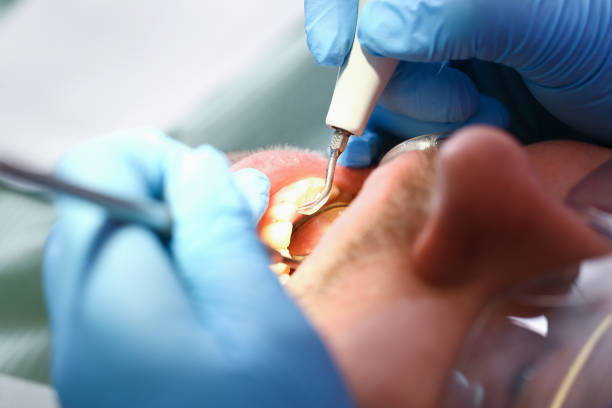 Best Root Canal Emergency Dentist  in Moline, IL