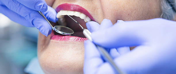 Best Dentist for Tooth Abscess  in Moline, IL